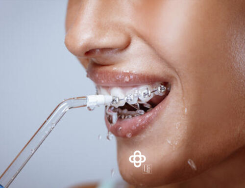 Irrigador dental: ¿Qué es y para qué sirve?