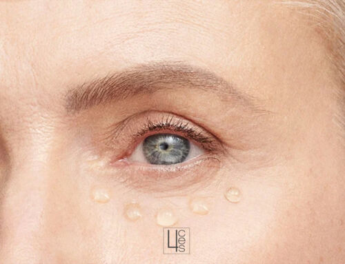 Tratamiento de relleno de ojeras con ácido hialurónico