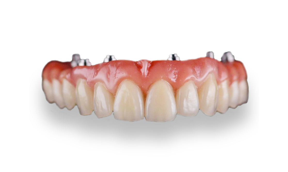 protesis oscar brandariz