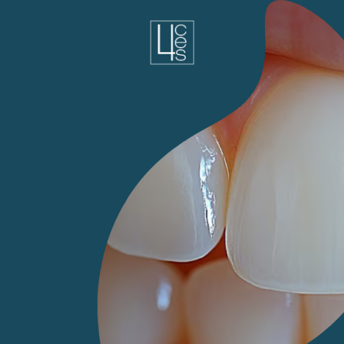 implantes dentales 4ces