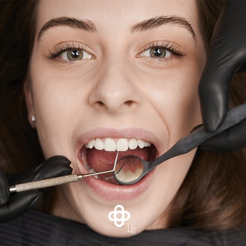 limpieza dental profunda