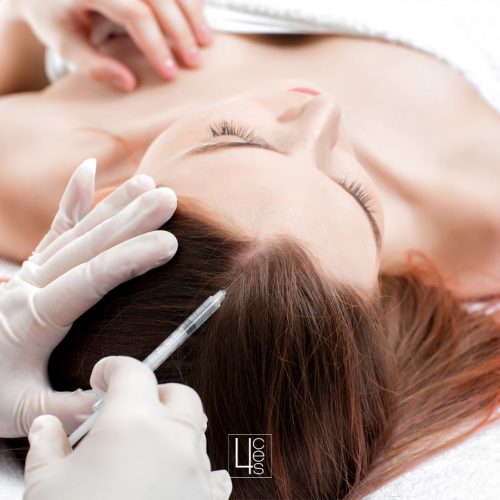 mesoterapiacapilar catroces web