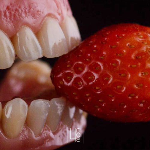 puenteseimplantesdentales catroces web